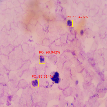 Detection of parasite from a blood sample